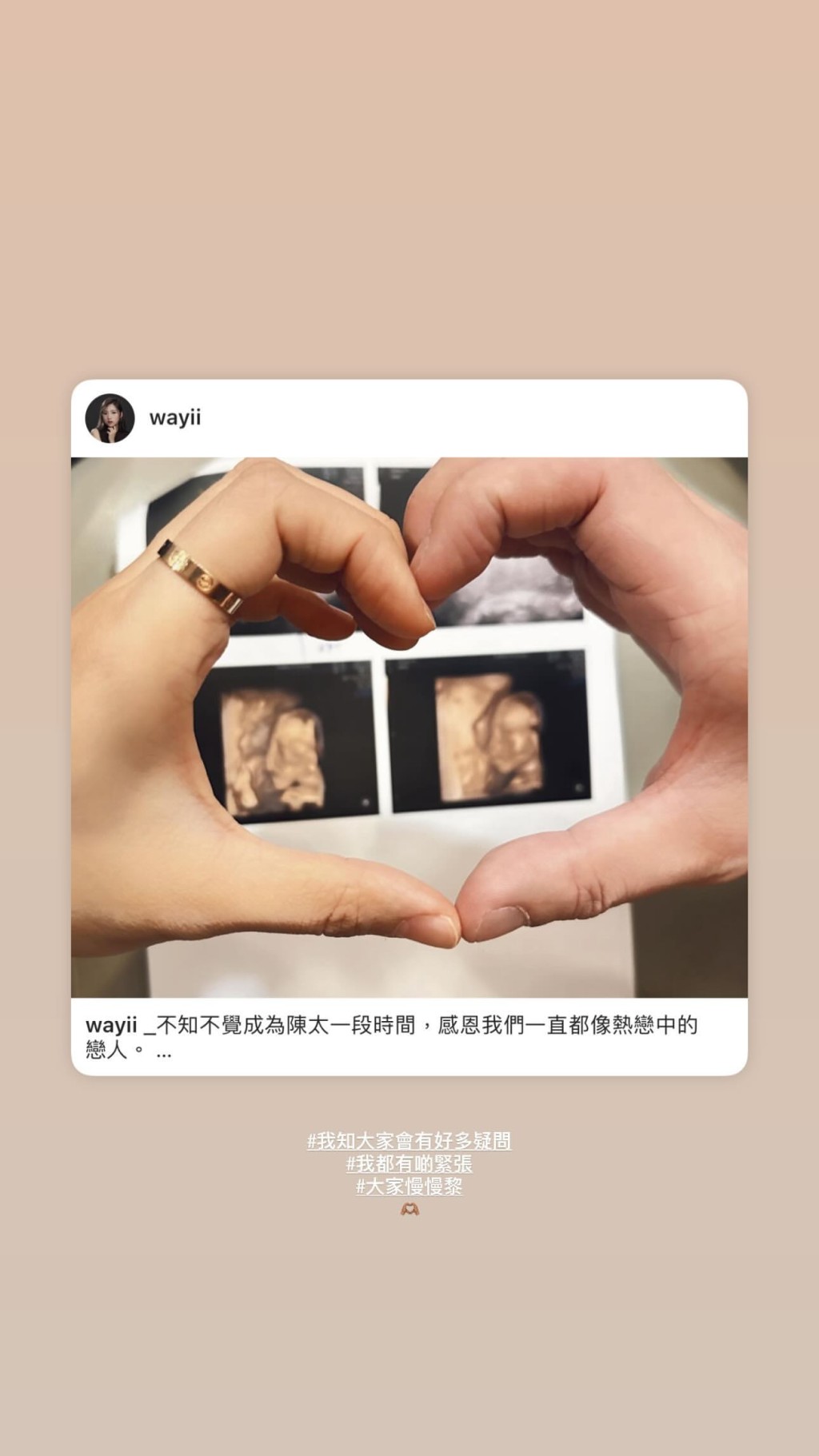 郑伊琪透露已怀孕19周加6天。