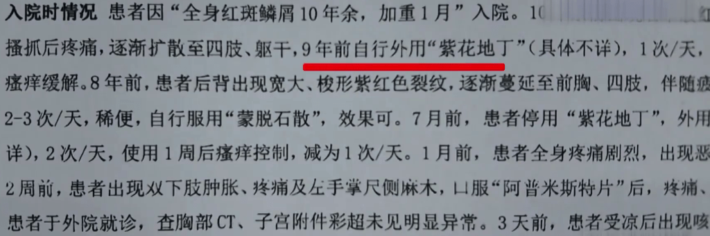 醫院報告指出患者常塗一種叫「紫花地丁」的藥膏。 醫院報告指出患者常塗一種叫「紫花地丁」的藥膏。