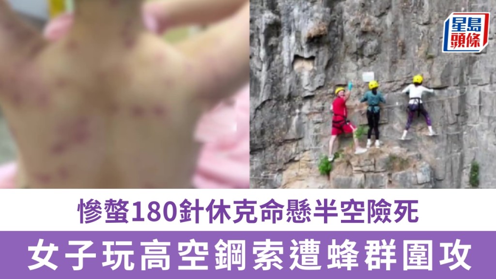 女子玩高空鋼索遭蜂群圍攻，慘螫180針休克命懸半空險死。