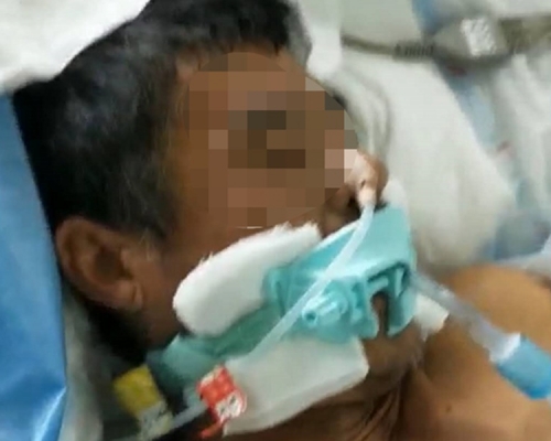 許雙高仍躺在ICU病房内昏厥不醒。網圖