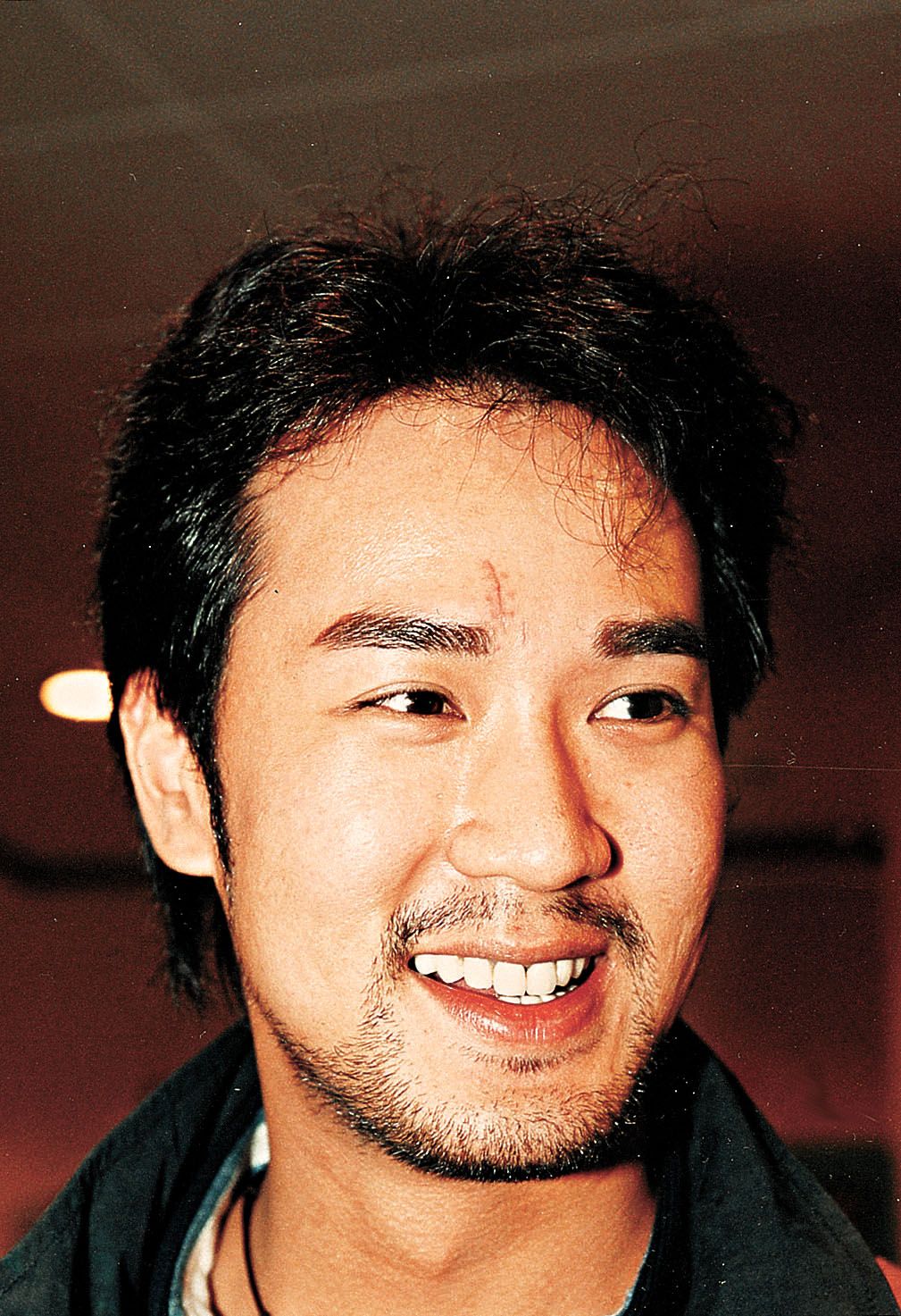 2000年，卢庆辉于澳门disco与有势力人士争执，眉心位置缝咗20针。