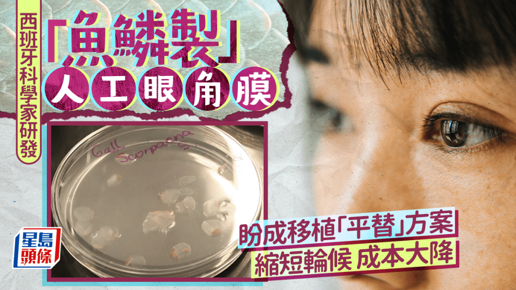 西班牙科學家研發  「魚鱗製」人工眼角膜 盼成移植「平替」方案  縮短輪候 成本大降