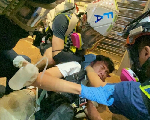 一名急救義工在銅鑼灣被催淚彈灼傷後背。城市廣播圖片