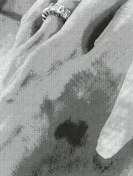 安祖蓮娜曾向FBI呈上自己被畢佬傷及手背和手踭的照片。