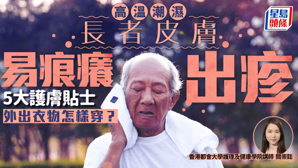高溫潮濕長者皮膚易痕癢出疹 專家教5大護膚貼士 外出衣物怎樣穿？