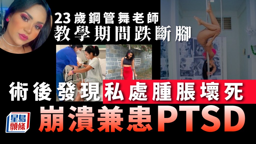 23歲辣妹跳鋼管舞跌斷腳 術後醒來發現私處腫脹壞死崩潰
