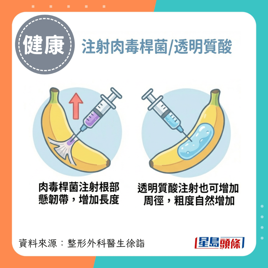 肉毒杆菌注射根部悬韧带，增加长度；透明质酸注射也可增加周径，粗度自然增加