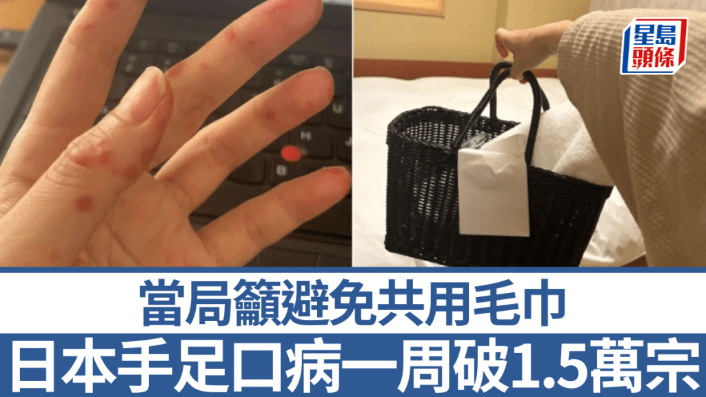 日本爆發手足口病疫情，官方提醒民眾及遊客切勿共用毛巾。小紅書