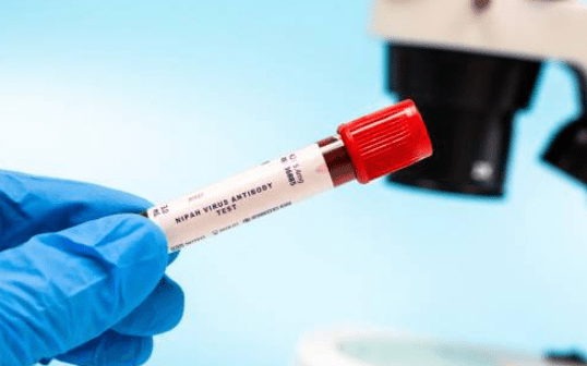 朱萊博士在衛生部的新聞發布會上表示，泰國果蝠與印度發現的果蝠品種相似。法新社