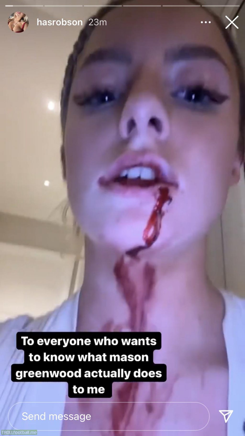 夏莉芝笠臣上載口角流血的短片，寫上：「大家看清楚格連活特怎樣對我！」  網上圖片