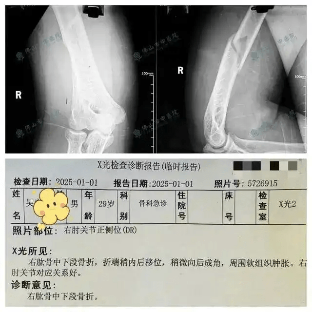 廣東壯男挑戰拗手瓜機械人，其中一名為29歲。 廣州日報