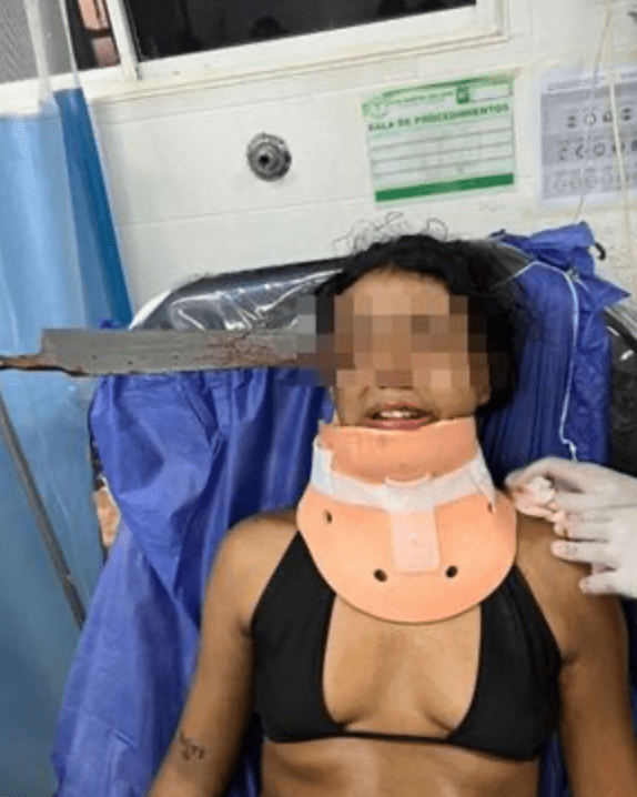 少女面部插着刀赴醫院救治的驚慄圖片在網上瘋傳。