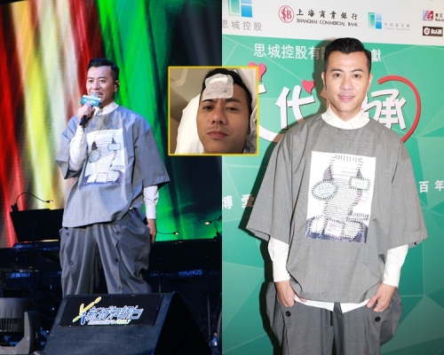 Edmond額傷漸康復,疤痕不太明顯。