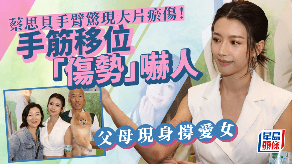 你好,我的大夫丨蔡思貝手臂驚現大片瘀傷!手筋移位「傷勢」嚇人 父母現身撐愛女