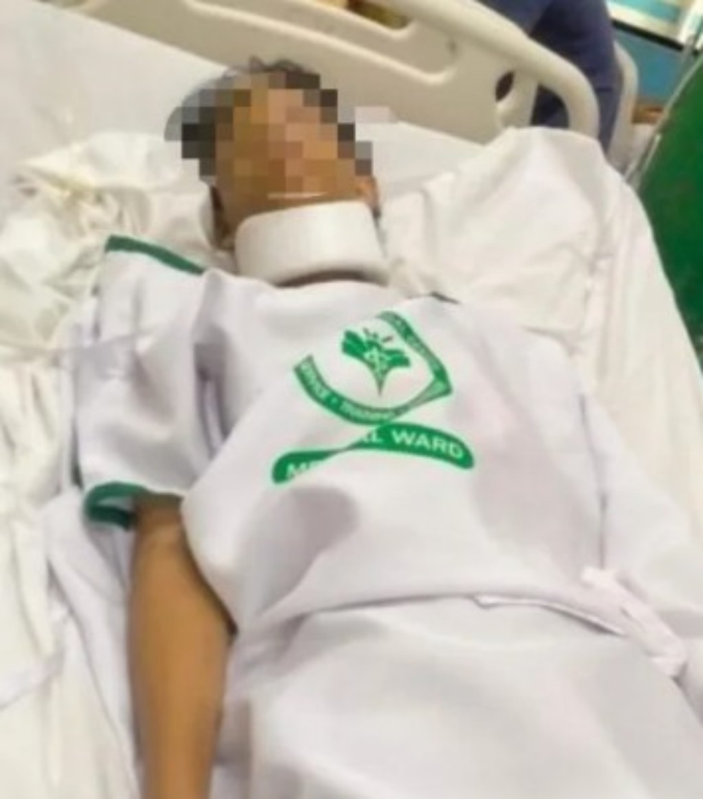 馬克的肺臟幾乎碎裂。