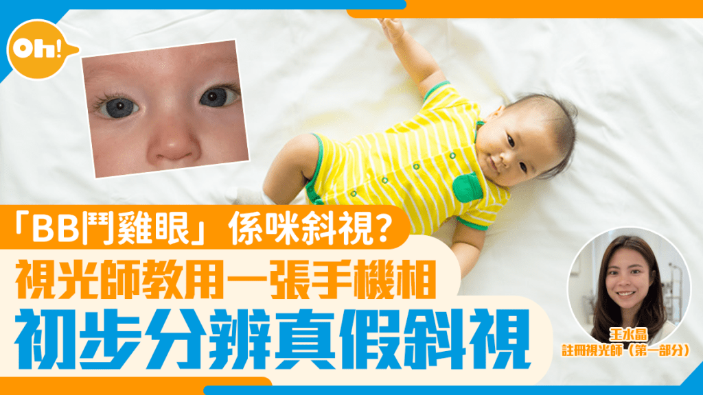 「BB鬥雞眼」係咪斜視？視光師教用一張手機相 初步分辨真假斜視