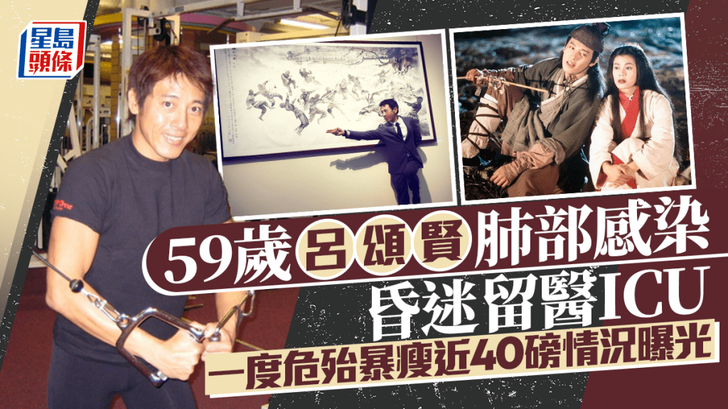 59歲呂頌賢肺部感染昏迷入ICU留醫14日   一度危殆暴瘦近40磅情況曝光