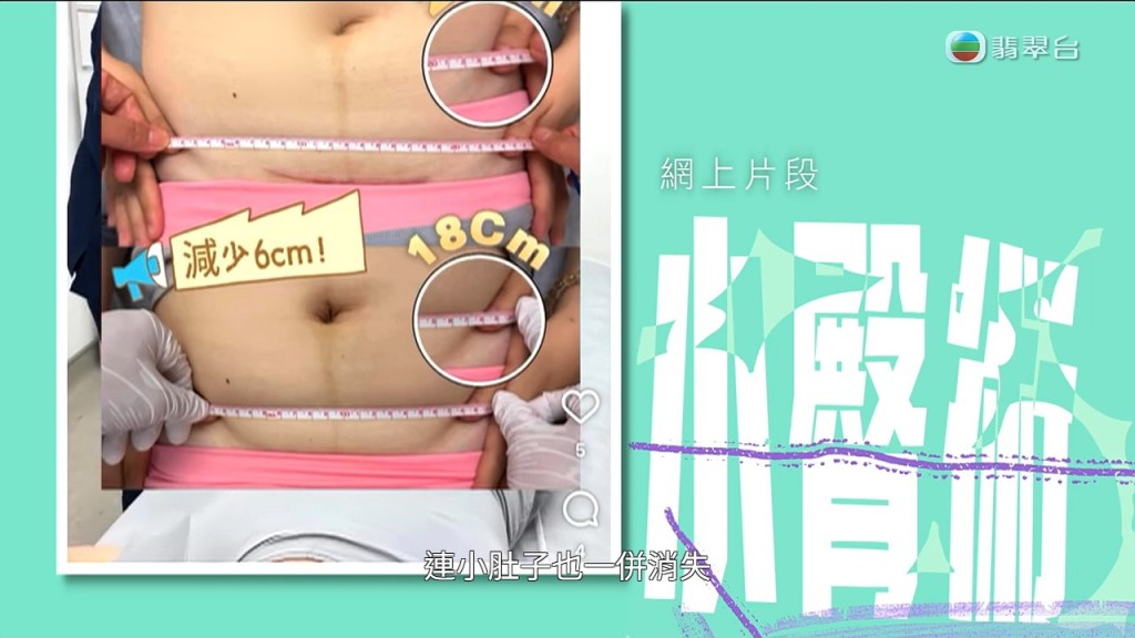 店方廣告標榜徒手推拿即可收窄小臀及減小腹圍。 店方廣告標榜徒手推拿即可收窄小臀及減小腹圍。