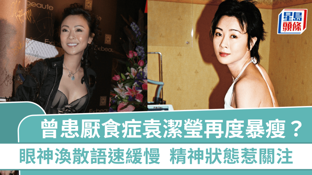 56歲袁潔瑩再度暴瘦？眼神渙散語速緩慢精神狀態惹關注 曾患厭食症體重僅75磅