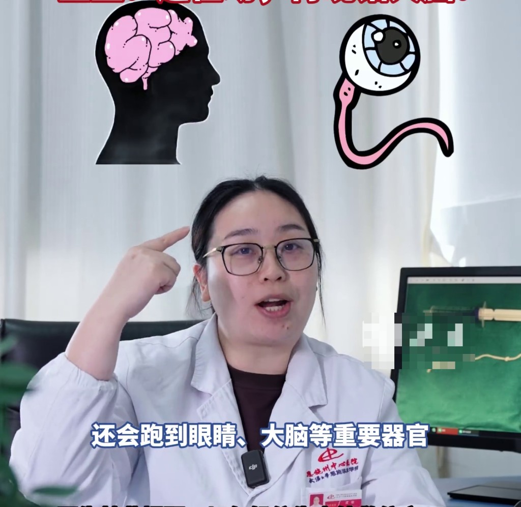 医生：此为裂头蚴，可致失明死亡。 极目新闻