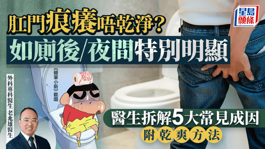 肛门痕痒=唔干净？如厕后/夜间特别明显 医生拆解5大常见成因 附干爽方法