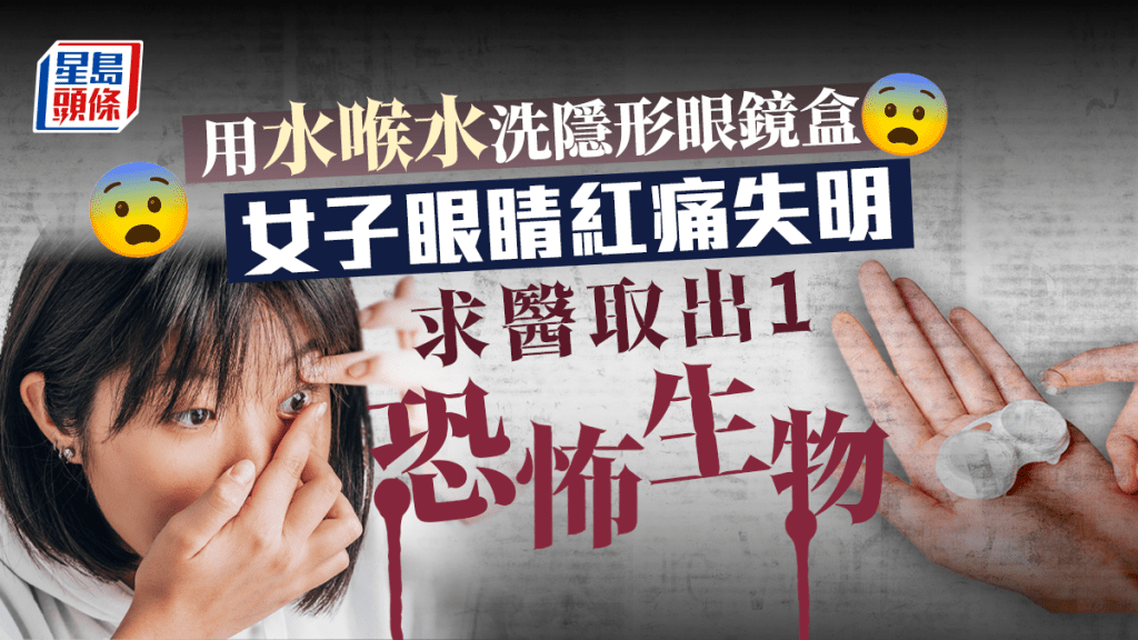 用水喉水沖洗隱形眼鏡盒竟然令眼睛發炎,最後導致失明?