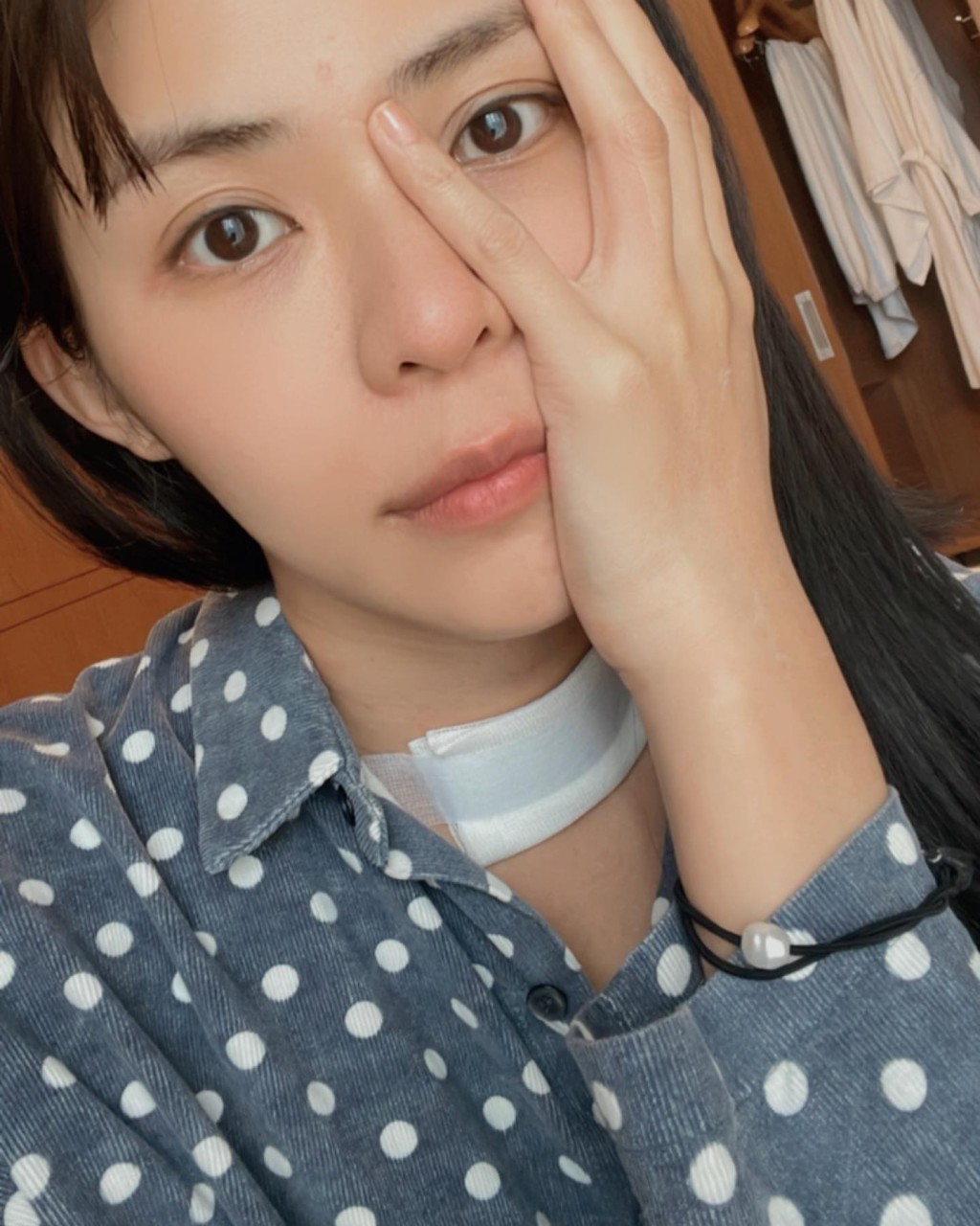 林萱瑜覺得自己術後的樣子變醜了。(圖片來源:「Kiki-林萱瑜」Facebook)