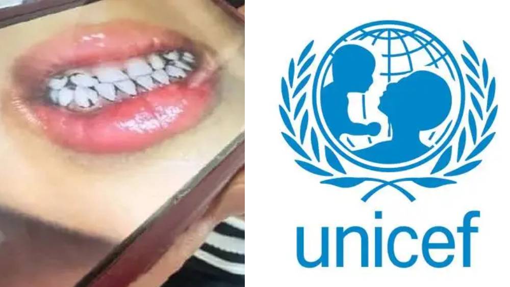 聯合國兒童基金會就天水幼兒血鉛異常事件深表關切。