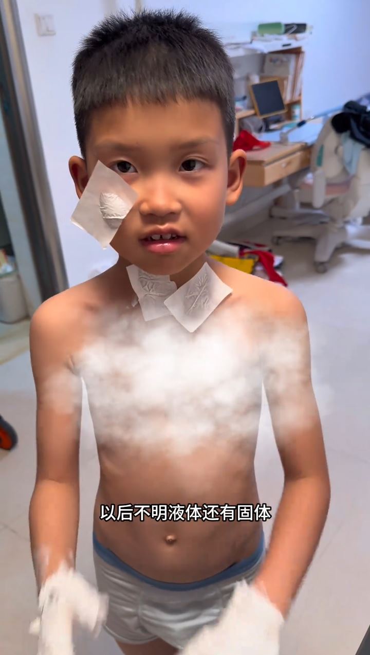 “虫虫”好奇打开灭火毯，致全身刺满玻璃纤维，又痕又痛。抖音