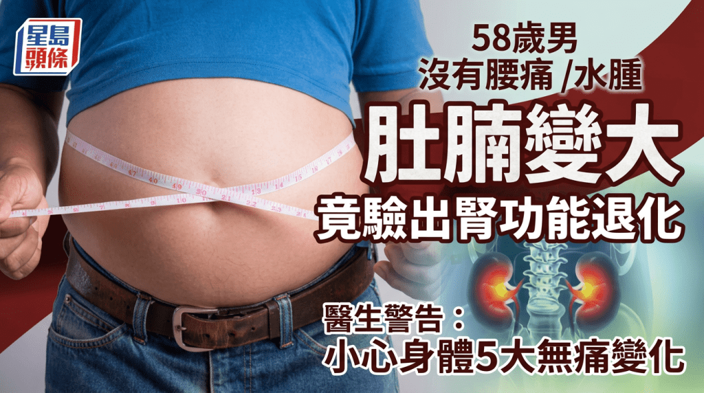 58歲男沒有腰痛/水腫 肚腩變大竟驗出腎功能退化 醫生警告：小心5大無痛變化