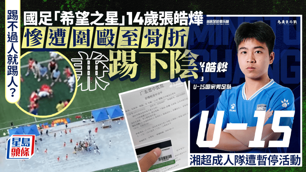 國足「希望之星」︱14歲張皓燁被毆至骨折  湘超成人隊蓄意踢下陰遭暫停活動
