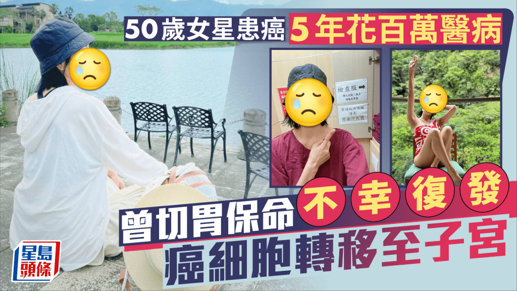 50歲女星患癌5年花百萬醫病 曾切胃保命不幸復發癌細胞轉移至子宮 揭致胃癌最大因素