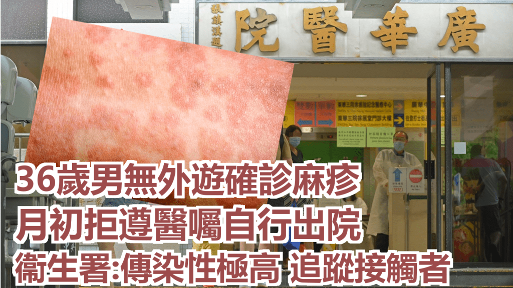 衞生署發言人說,麻疹由麻疹病毒引起,傳染性極高。資料圖片