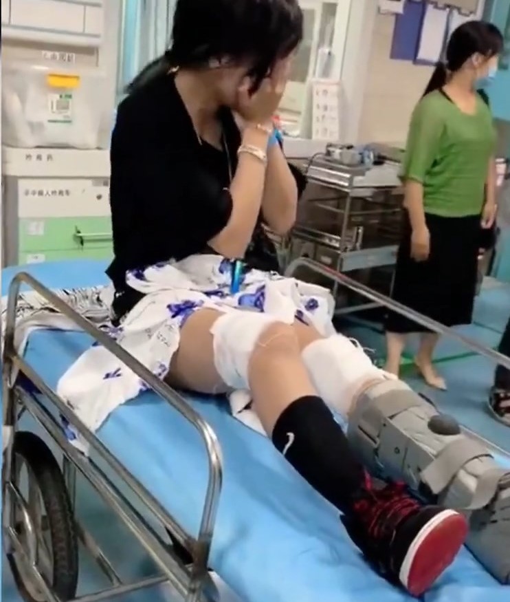 多年前，「石膏ProMax」曾駕車摔斷腳。