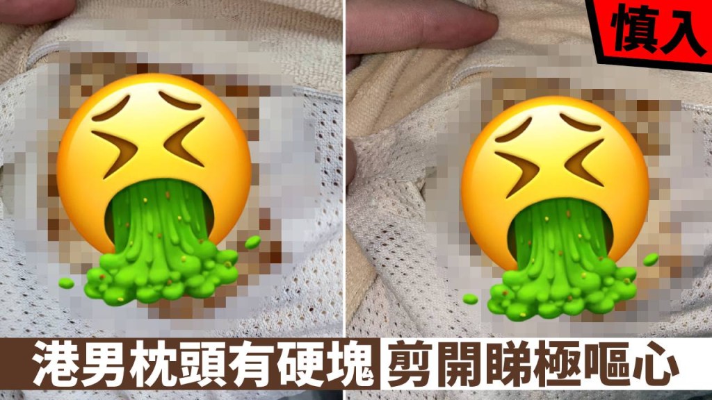 港男表示自己枕頭出現密密麻麻的塊狀物,引起熱議。網圖