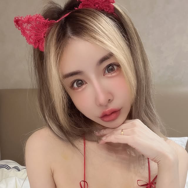 戴眼罩滴眼藥水：「等提眼肌自己降下來，整形之前真的要好好思考，不要一時衝動。」事實上，雪碧早在8月時就曾在社交網上分享過提眼肌手術失敗。