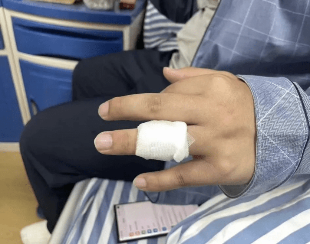 記者被打至手指骨折。