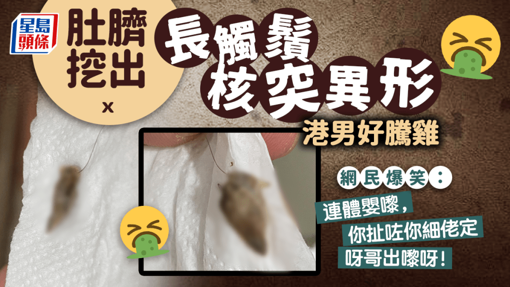 臍挖出核突異形港男騰雞 網民爆笑：快啲塞番臍帶入去