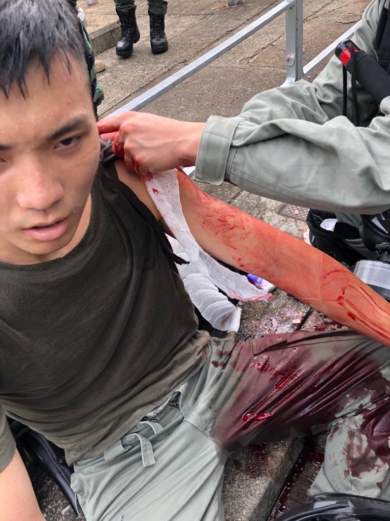 一名防暴警察在天后被人用刀刺傷。網上圖片