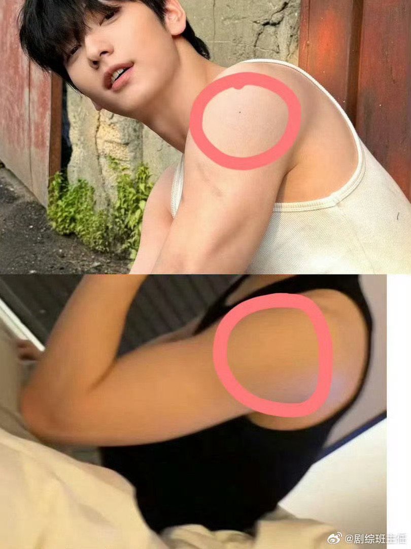 粉絲對比外洩照片稱相中的秀彬手臂沒有癦，因此相信私密照是AI合成。