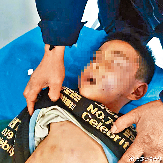 涵涵被打至滿身傷痕,最終傷重死亡。微博 涵涵被打至滿身傷痕,最終傷重死亡。微博