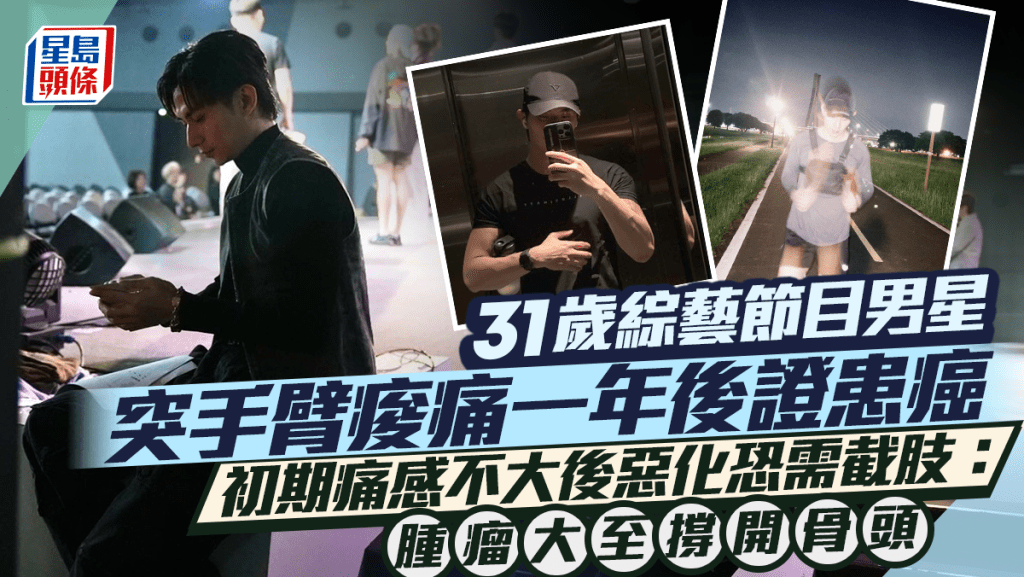 31歲男星突手臂痠痛一年後證患癌    初期痛感不大後惡化恐需截肢：腫瘤大至撐開骨頭