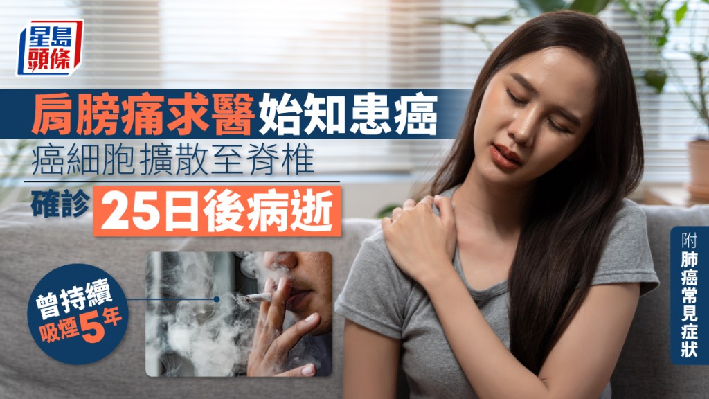女子肩膀痛求醫揭患肺腺癌。
