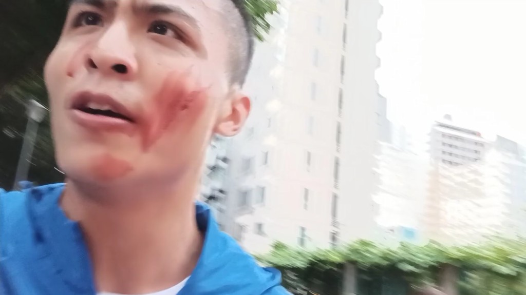 刘马车事后开直播声称会到警署自首，当时已满面鲜血。(Youtube画面)