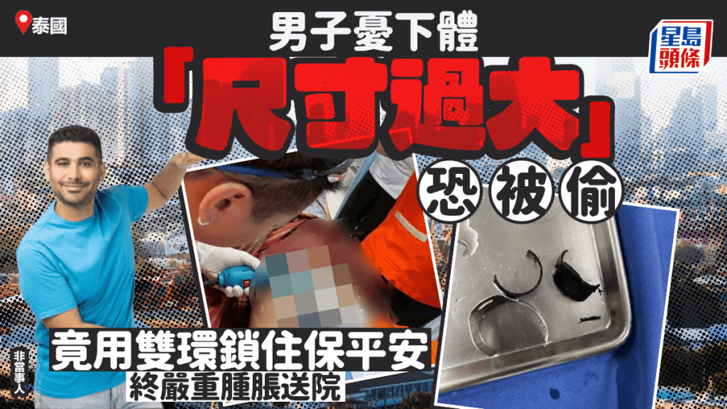 泰男憂「尺寸太大」被偷 竟用兩環鎖住生殖器 腫成拳頭急送院
