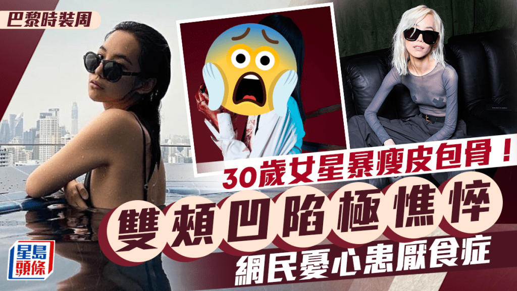 30歲女星暴瘦至皮包骨！雙頰凹陷臉容憔悴  真空上陣僅以交叉遮胸嚇親網民