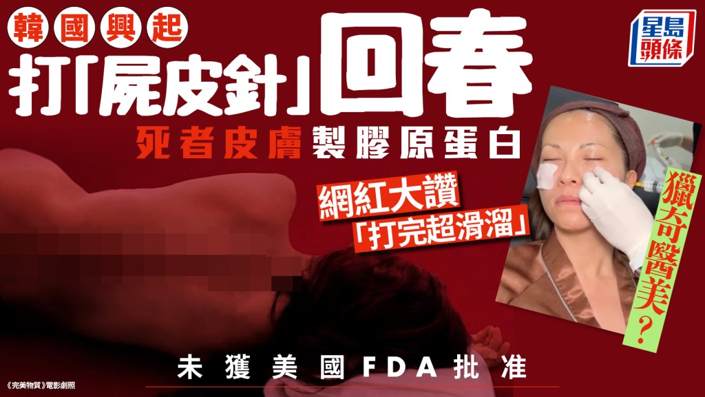獵奇醫美？韓國興起打「屍皮針」回春 用死者皮膚製膠原蛋白 美國FDA未批准多國診所搶先提供？