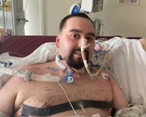 美國24歲男子Blaze拒打新冠疫苗後卻不幸染疫，須接受雙肺移植手術以保命。網圖