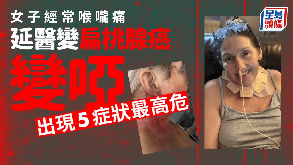 女子喉嚨痛變扁桃腺癌失聲，專家提醒5症狀最高危。