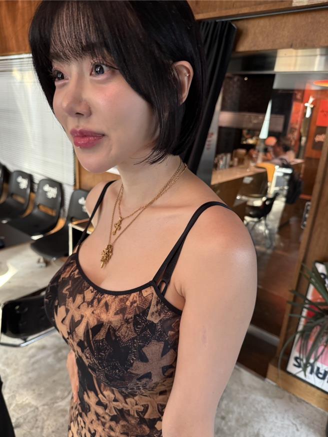 DJ SODA初戀遇着酗酒家暴Rapper,曾被對方爆樽襲擊,左手手臂至今仍見5厘米長傷痕。(中時新聞網) DJ SODA初戀遇着酗酒家暴Rapper,曾被對方爆樽襲擊,左手手臂至今仍見5厘米長傷痕。(中時新聞網)